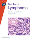 Lymphoma (eBook)